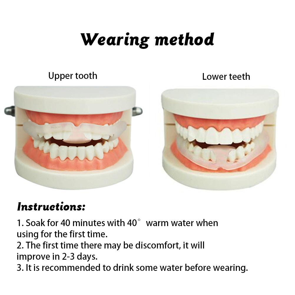 2PCS Anti Molar Braces Adjustable Anti Grinding Braces Teeth Night Protector