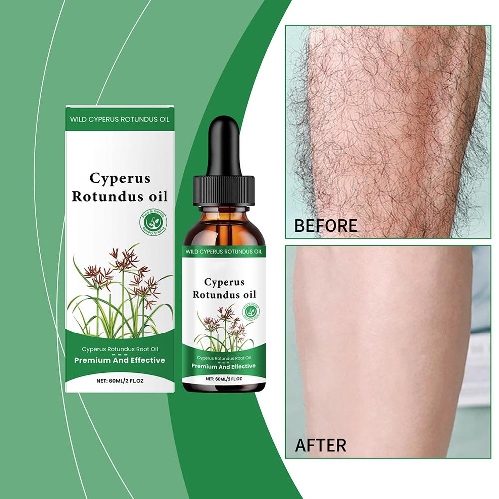 Масло для удаления волос Cyperus Rotundus Питательное масло для удаления волос Cyperus Rotundus 60 мл Масло Mo O1U6