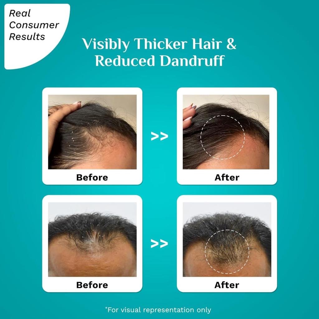 Pilgrim 3% Redensyl 4% Anagain Усовершенствованная сыворотка для роста волос 30 мл Для кожи головы, склонной к шелушению Уход для густоты волос Поддержка