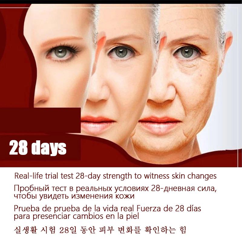 3в1 RF EMS устройство для красоты лица, импульсная машина для лица, лифтинг шеи, удаление мешочков для красоты глаз, подтяжка машины, омоложение кожи