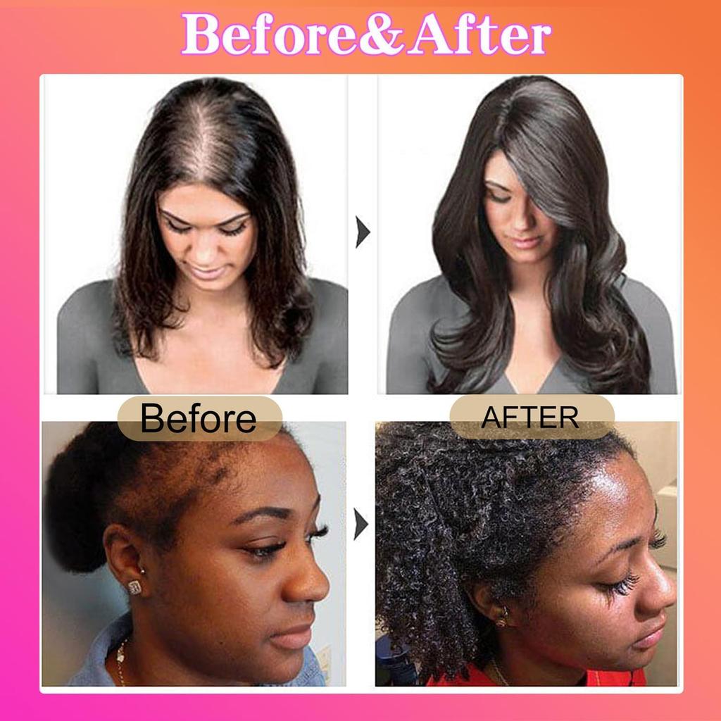 Масло Botanix Batana для роста волос, Натуральное масло для роста волос Botanix Batana, Нерафинированное масло Batana, для мужчин и женщин