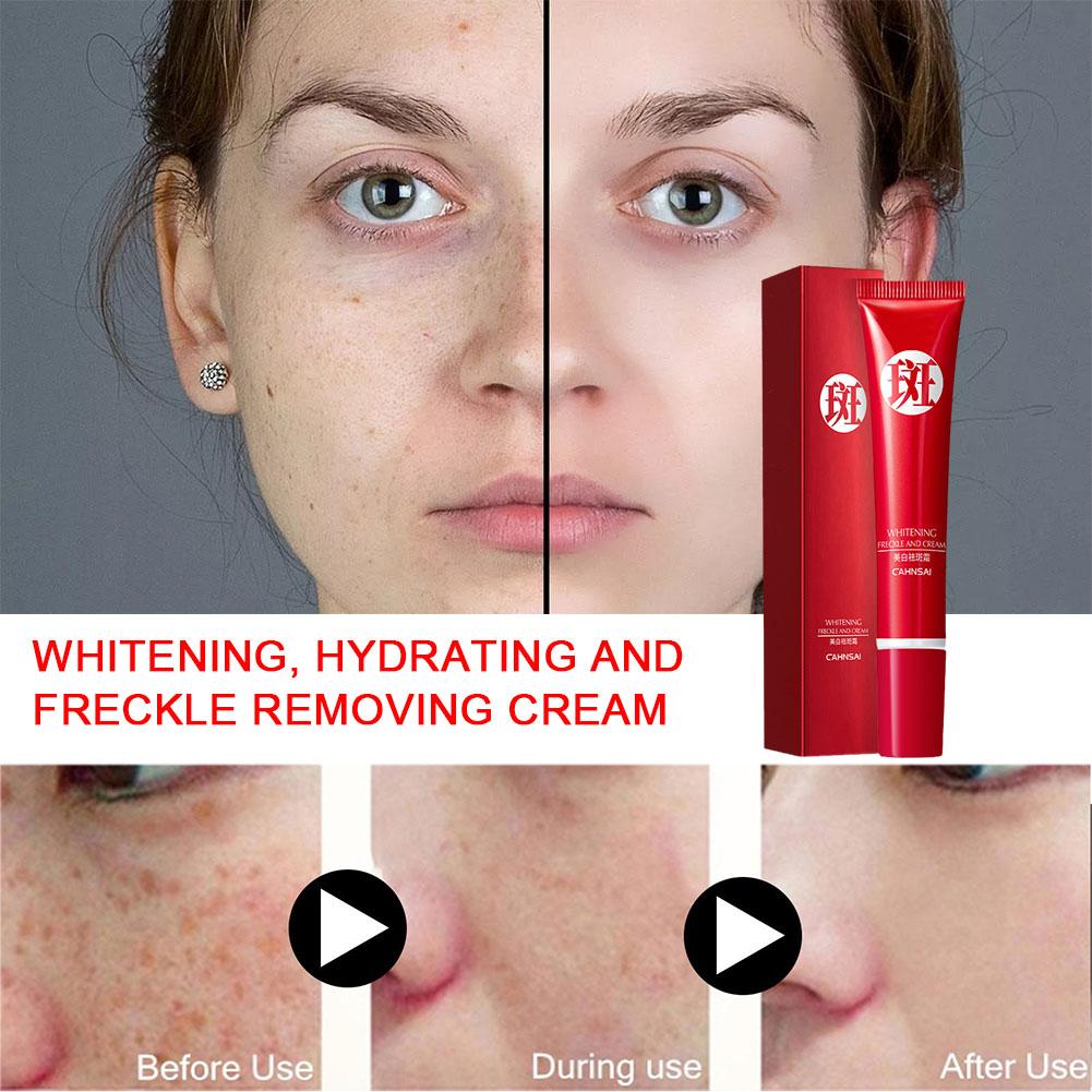 Freckle Removing Dark Spot Corrector Cream 20g Plant Lotion Lightening Anti-Age Extract Whiteni U4K2
