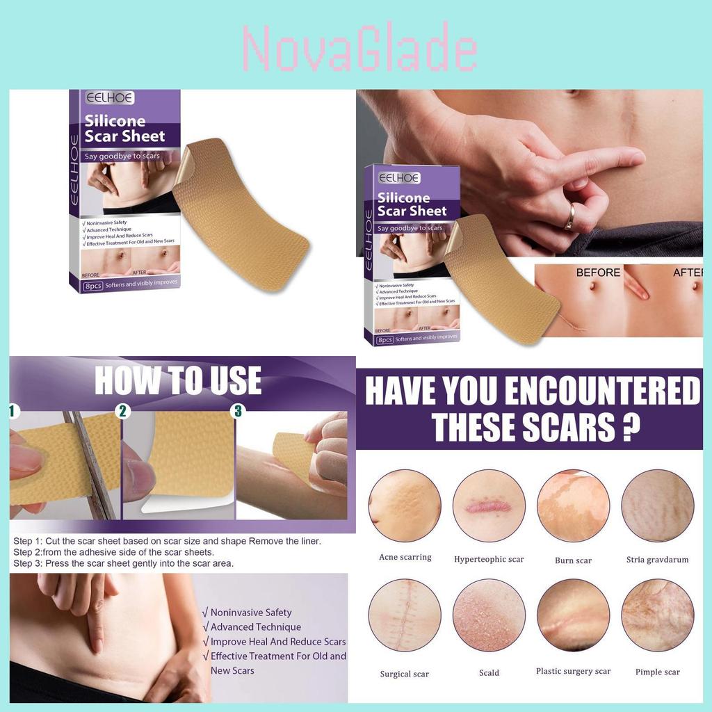 Eelhoe Silicone Scar Patches For Reducing Pregnancy And C-section Scars Effectively