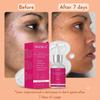 SILKMIST 10% Сыворотка для лица Super Brightening & Glow с витамином С, ниацинамидом, койевой кислотой, глутатионом и гиалуроновой кислотой – Уменьшает темные пятна и пигмент
