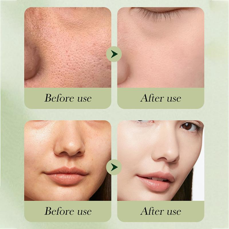 Набор для ухода за кожей Avocado Luxury Skincare Set Набор для очищения и увлажнения кожи лица, омолаживающий набор, набор для ухода за кожей против морщин из шести предметов