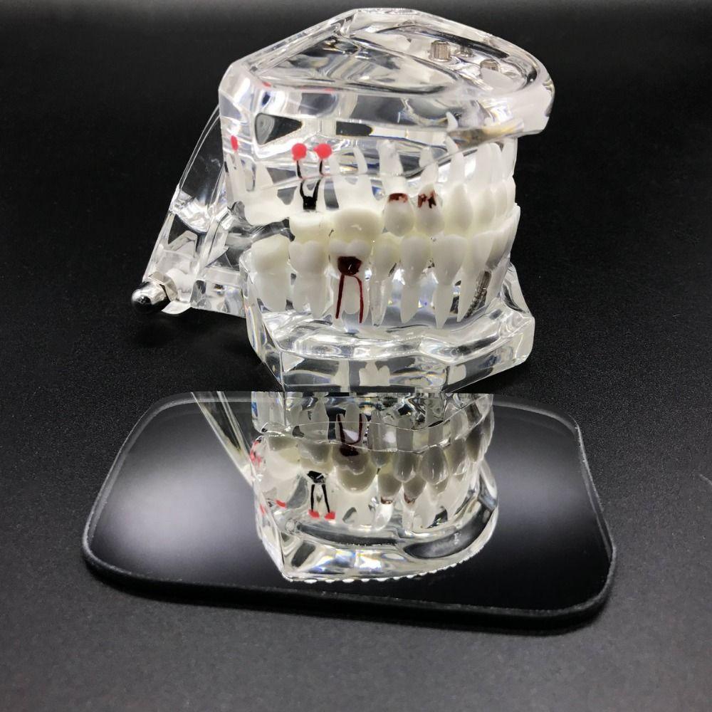 5 шт./набор Стеклянный внутриротовой стоматологический рефлектор Двустороннее зеркало Внутриротовой рефлектор Стоматология