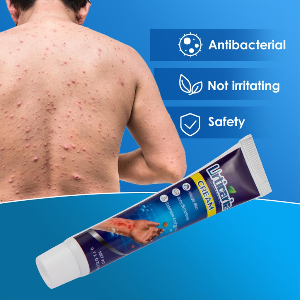 20 г местного крема от крапивницы: Эффективное средство от зуда, быстро снимает раздражение кожи, рекомендовано дерматологами