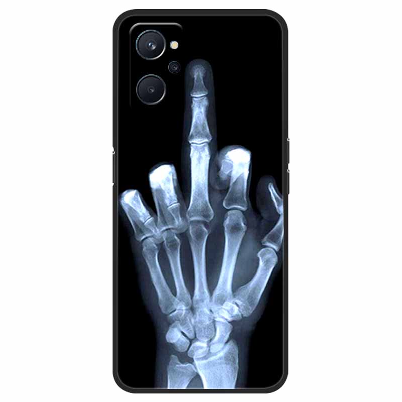 Для Coque Realme 9i чехол противоударный мягкий силиконовый чехол из ТПУ для oppo Realme 9i 9 i i9 Realme9i чехлы для телефонов 9i милый мультфильм