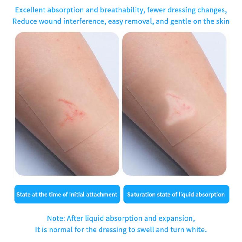 1/5 шт. Самоклеящиеся пластыри Гидроколлоидная повязка Невидимые Дышащие Пластырь для ран Лейкопластырь Клейкие бинты Кожный пластырь