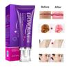 Gel Lips Whitening Areola Labia Nipple Tender Pink Cream Body Care