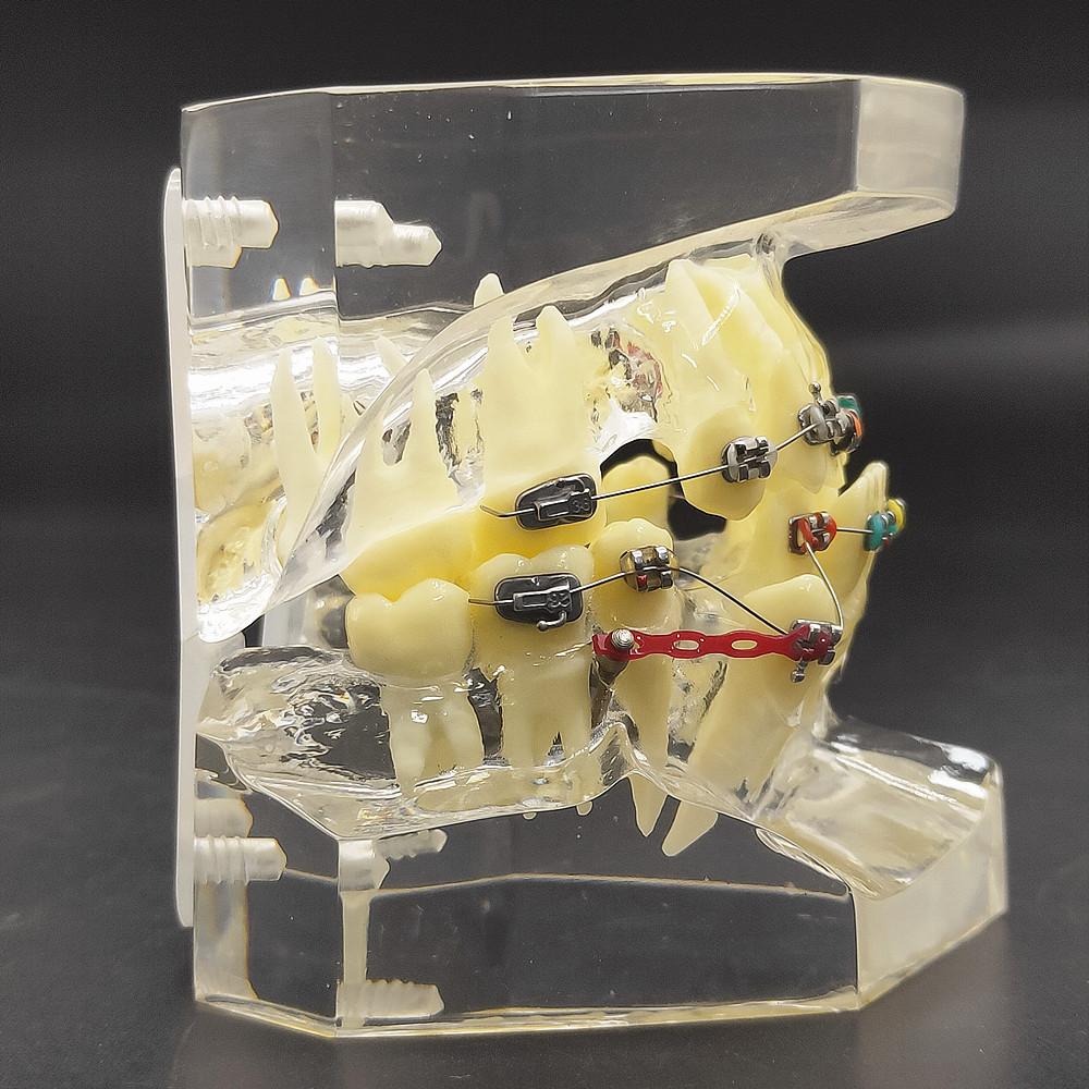 1 шт., прозрачная стоматологическая ортодонтическая модель прикуса с брекетами, буккальная трубка дуги для общения с пациентом