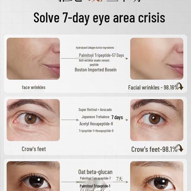 RUYI Concentrated Anti-Aging Eye Cream