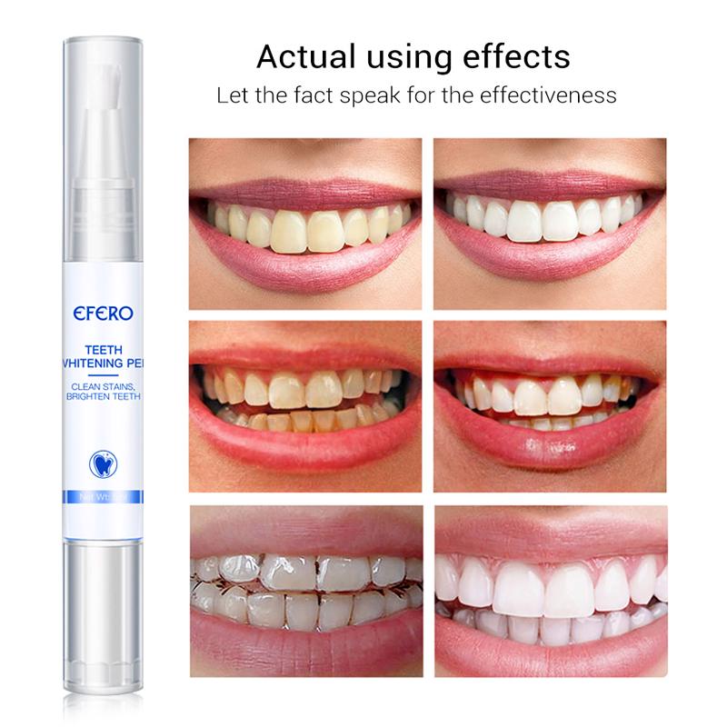 Карандаш для отбеливания зубов