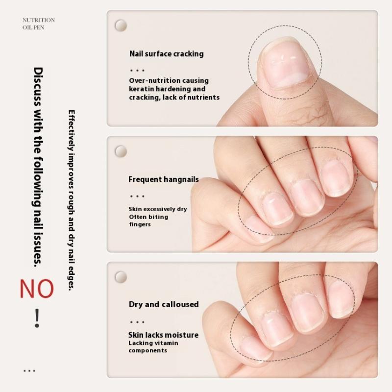 Масло для кутикулы Уход за ногтями Питательное масло Карандаш Восстановление ногтей Руки 15 ароматов 5 мл Гель-лак для ногтей Питание кожи Карандаш Маникюр Лечение