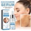 Сыворотка с ниацинамидом осветляет мелкие морщинки, увлажняет, осветляет, гидратирует и борется с морщинами.