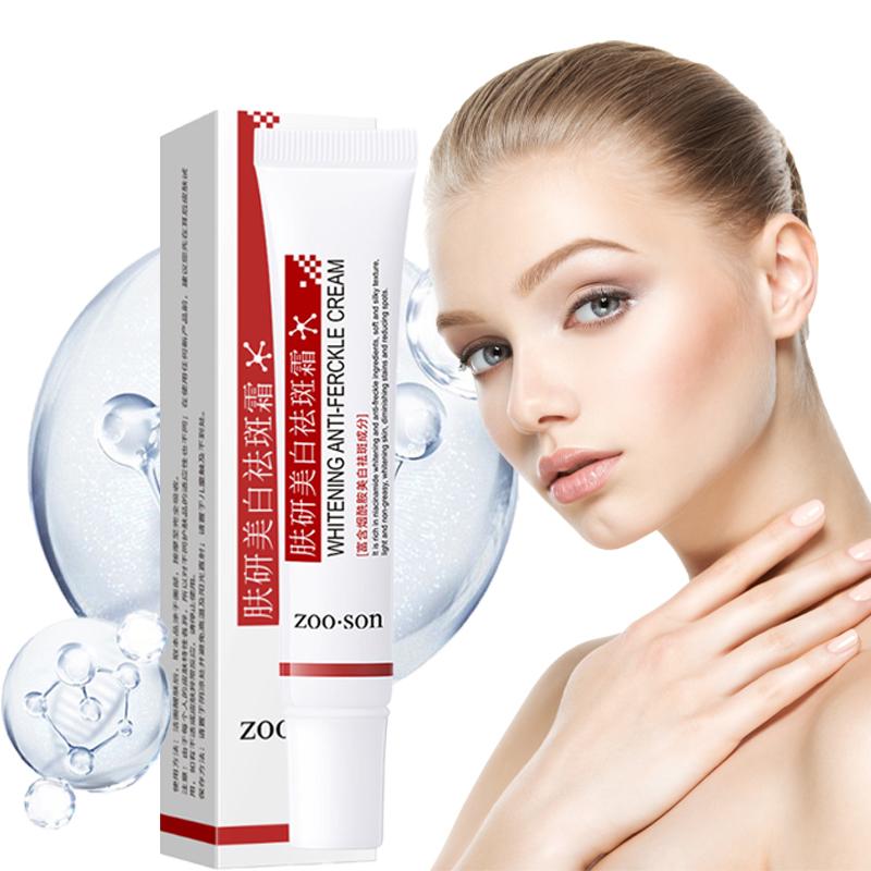 Отбеливающий крем против веснушек, увлажняющий, осветляющий, мягкий шелковистый, освежающий, нежирный крем для удаления веснушек, крем для лица