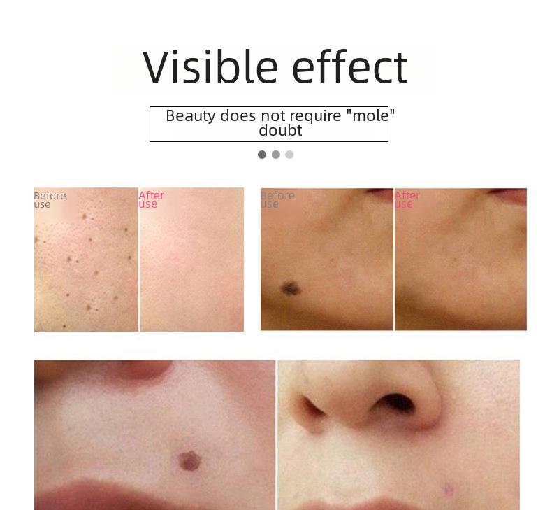 Набор из 12-скоростных ручек для удаления родинок: устройство для удаления родинок, ластик для черных родинок, очиститель для бровей, восстанавливающий крем, косметический карандаш, не оставляющий следов.