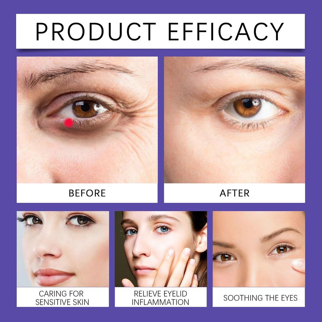 South Moon Eye Soothing Serum Moisturizes and Softens Skin To Soothe and Improve Eye Condition Serum