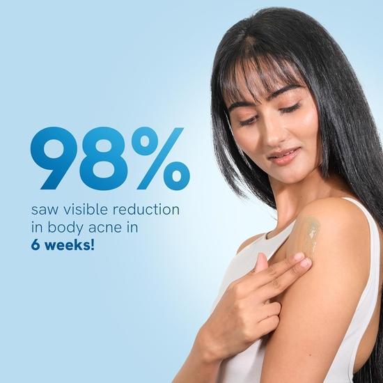 Be Bodywise Strawberry Skin Pack | With 1% SA Body Wash, 5% Lactic Acid Body Lotion & 10% AHA Scrub | Exfoliates | 650ml