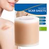 Self-Adhesive Silicone Scar Tape Scar Sheets Soft Silicone Reusable Scar Away Scar Tape Effective Skin Care Strips 4x50cm