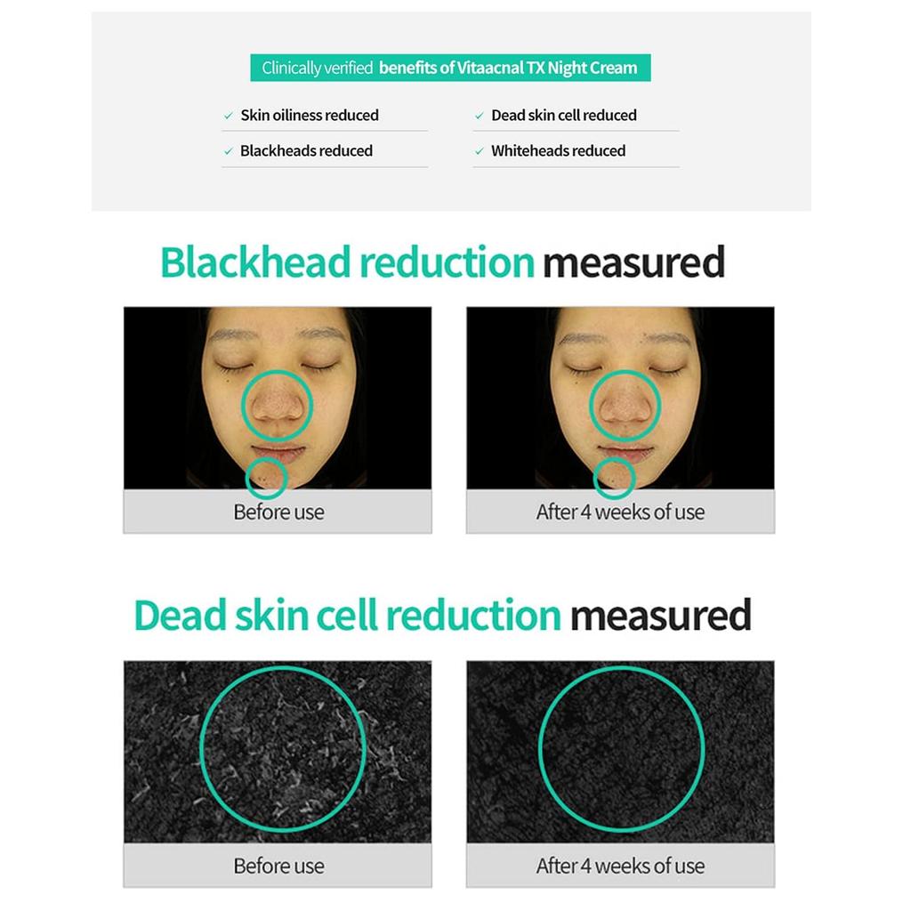 DR.DIFFERENT Vita Acnal TX ночной крем 20 мл