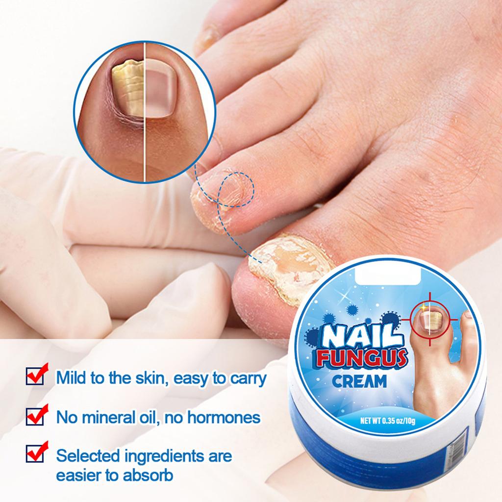 Plaster New Bright Nail Plaster Relieves Onychomycosis And Nail Care