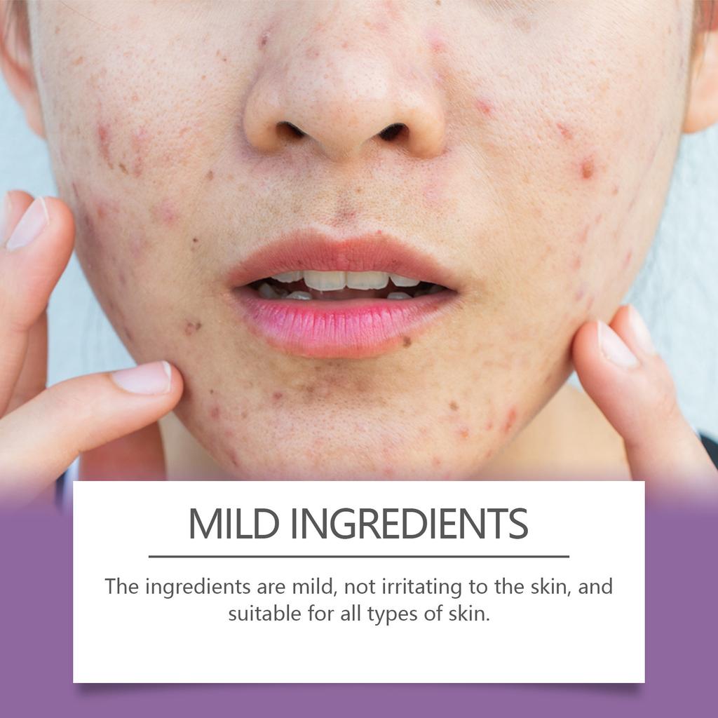 Невидимые пластыри от прыщей Jaysuing Гидроколлоидные наклейки от прыщей для удаления пятен, уход за кожей лица