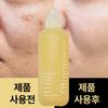 Cosnology Super Glutamine C Whitening Cica Spot Blemish Skin Vitamin C Serum Large Capacity 150ml 1pc, 1 Bottle