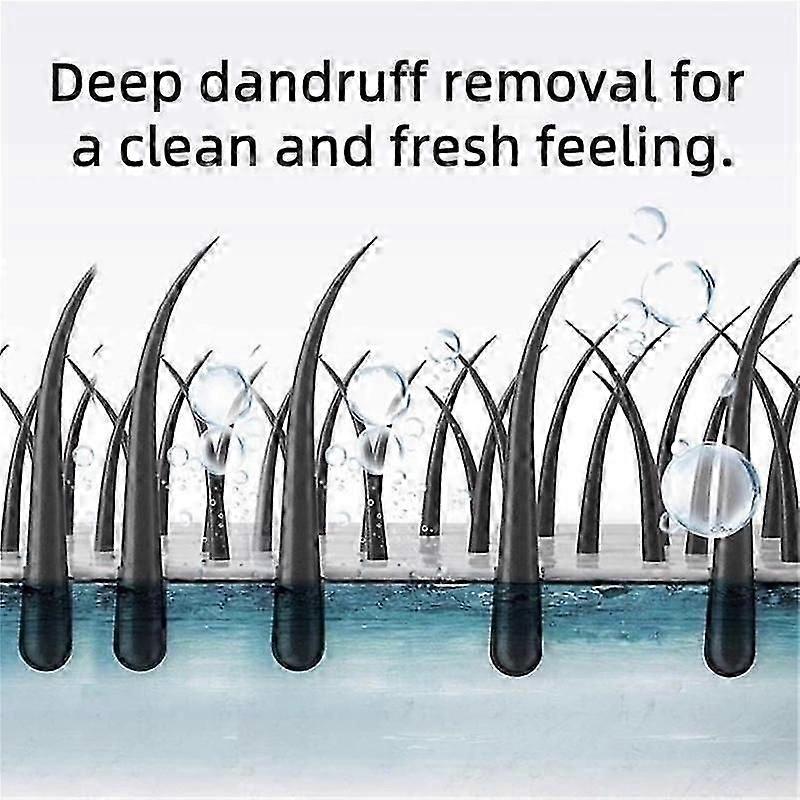 Selenium Disulfide Anti Dandruff Shampoo Helps Control Oil and Reduce Dandruff, Gentle Cleansing Shampoo for Dandruff, Dry & Oily Hair, Fresh, Soothin