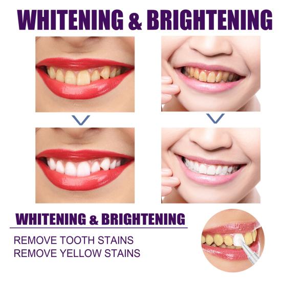 3ml Teeth Whitening Pen Safe Simple Operation Non-irritating Effective Portable Anti-pigmentation Eco-friendly Teeth Whitening Essence Pen for Home