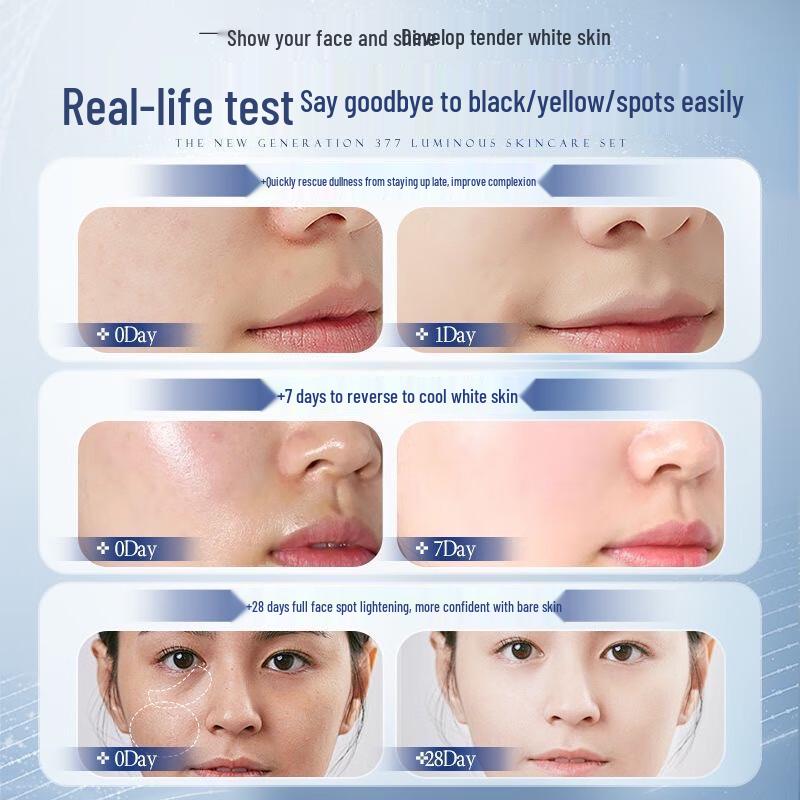 BEAI 577 Отбеливающая и осветляющая пигментные пятна аминокислотная пенка для умывания