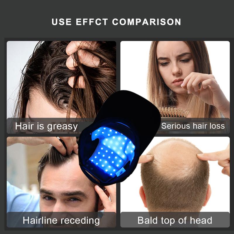 Лазерная терапия, шлем для роста волос, устройство против выпадения волос, колпачок для восстановления роста волос, 48 шт., лазер