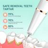 Ультразвуковой очиститель зубного налета Портативный электрический стоматологический скалер USB-перезаряжаемый прибор для удаления зубного камня Устранитель зубного камня Инструменты для чистки зубов