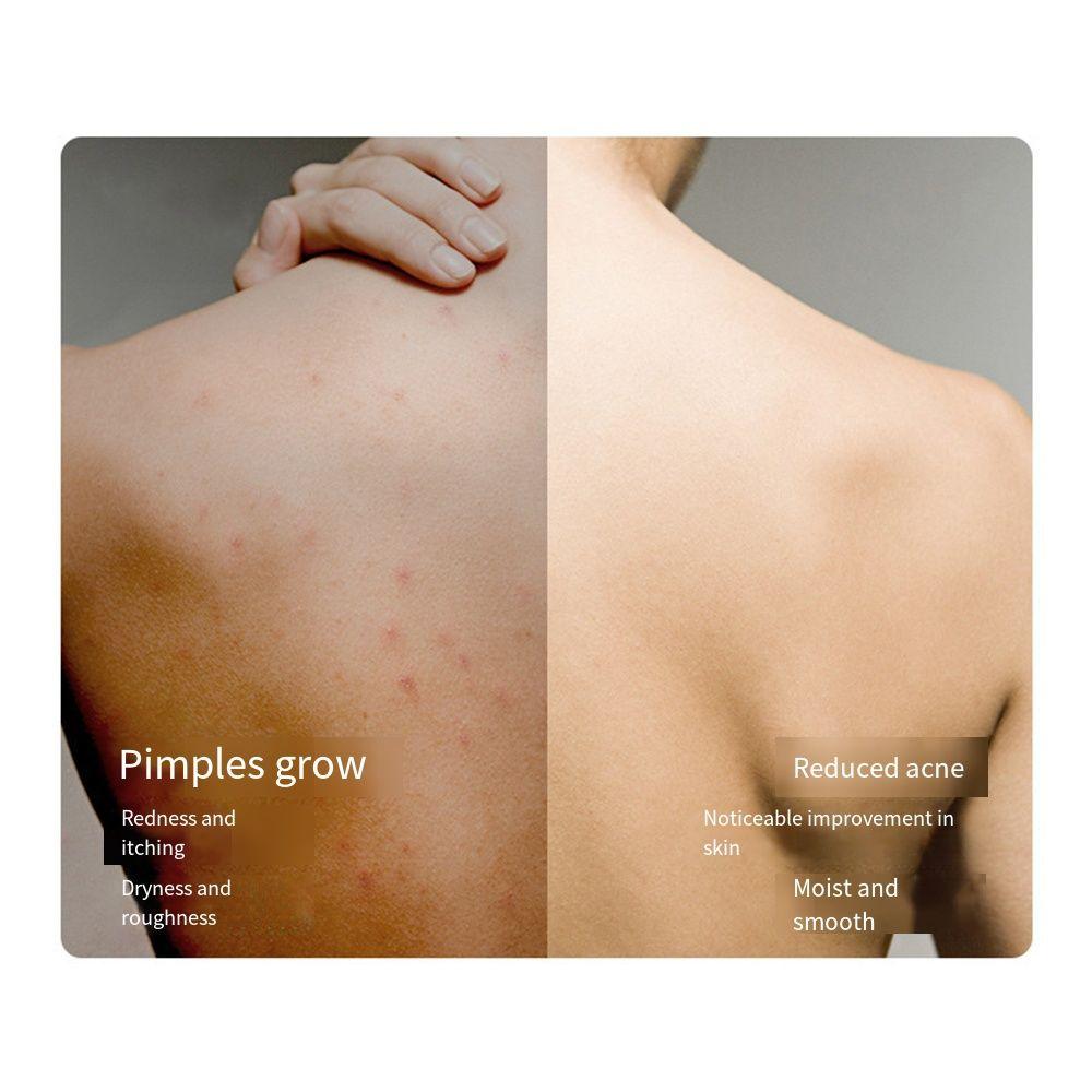 Эффективная очистка спины Массажная щетка для чистки настенный душ массажер коврик спа