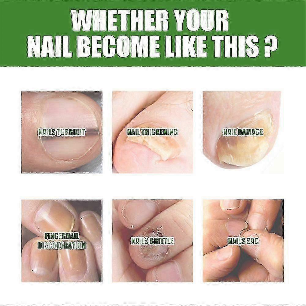 South Moon Nail Care Roller Balls - Nourishing Massage for Stronger, Faster-Growing Nails with 7-Day Nail Growth Formula New Arrival