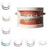 1 Pair Colorful Orthodontic Ligature Ties Dental Decorations Metal Bracket  Teeth