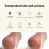 Электрическое устройство для педикюра ног, перезаряжаемая пилка для удаления мозолей, пластиковые инструменты для пилки для ног, розовый
