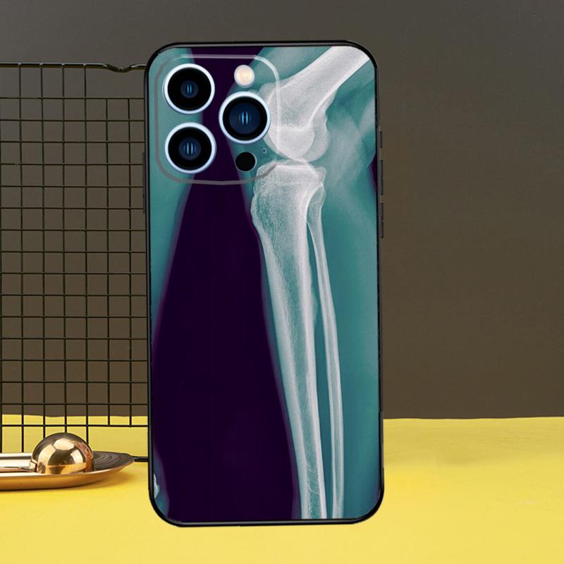 Рентгеновский чехол для телефона с анатомией человека для iPhone 12 13 Mini 11 14 Pro Max X XS XR Max 7 8 Plus SE, мягкий чехол Fundas
