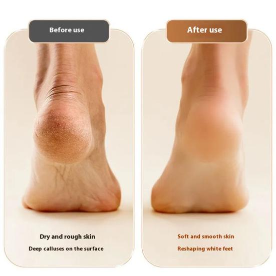 Electric Foot Polisher Electric Foot Callus Remover Waterproof Foot Grinder for Dry Skin Rechargeable High-Speed Spin Foot Care Tool for Men Women