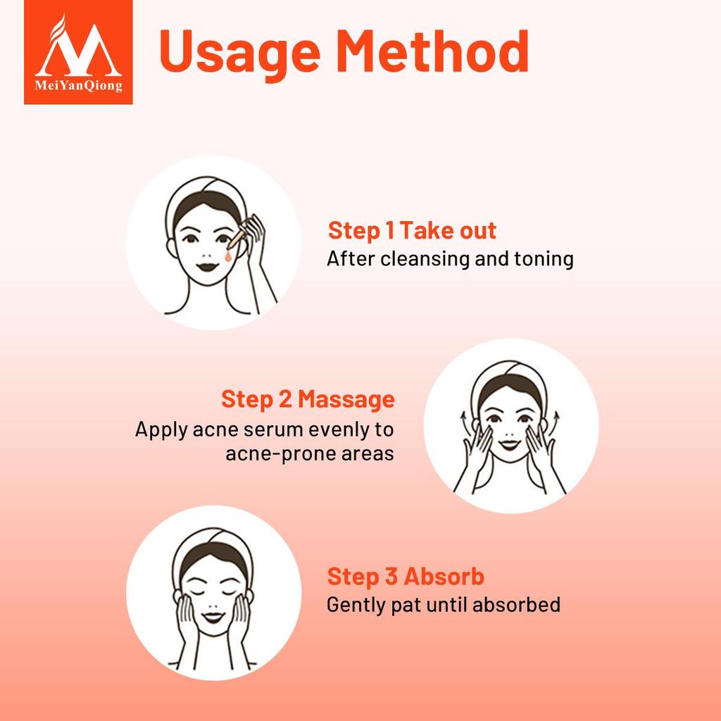 Сыворотка на травах против акне, предотвращает появление морщин. Уменьшает поры. Контролирует жирность кожи лица