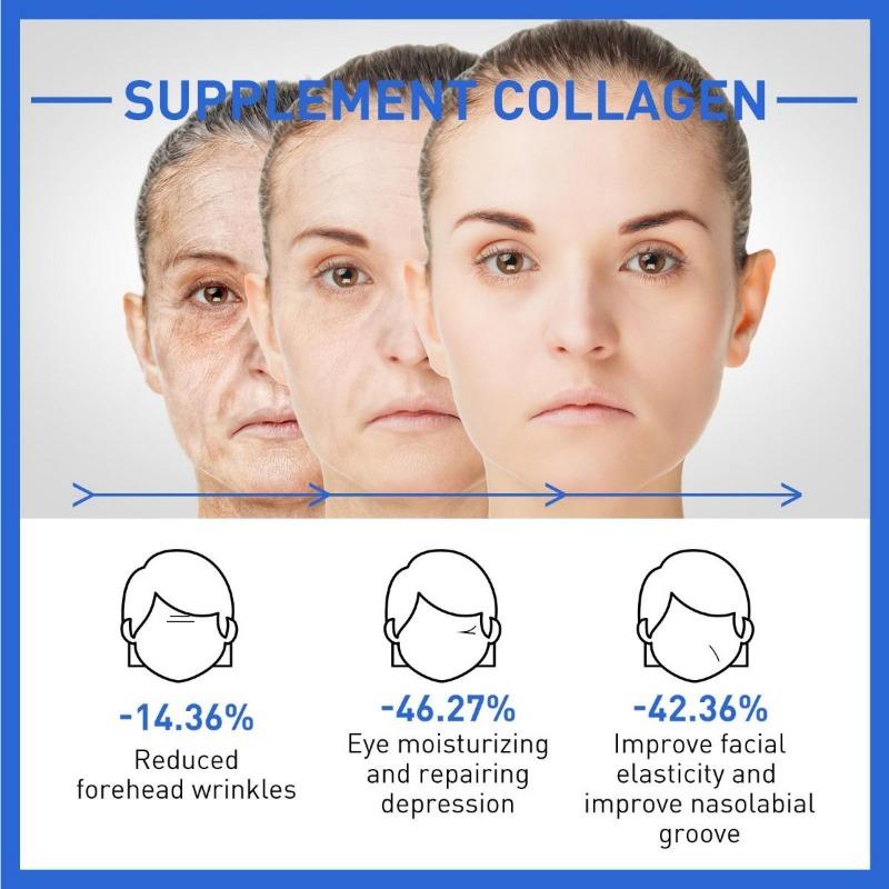 Collagen Anti-wrinkle Essence Reduces Facial Fine Lines and Wrinkles, Tightens Nasolabial Folds and Prevents Aging