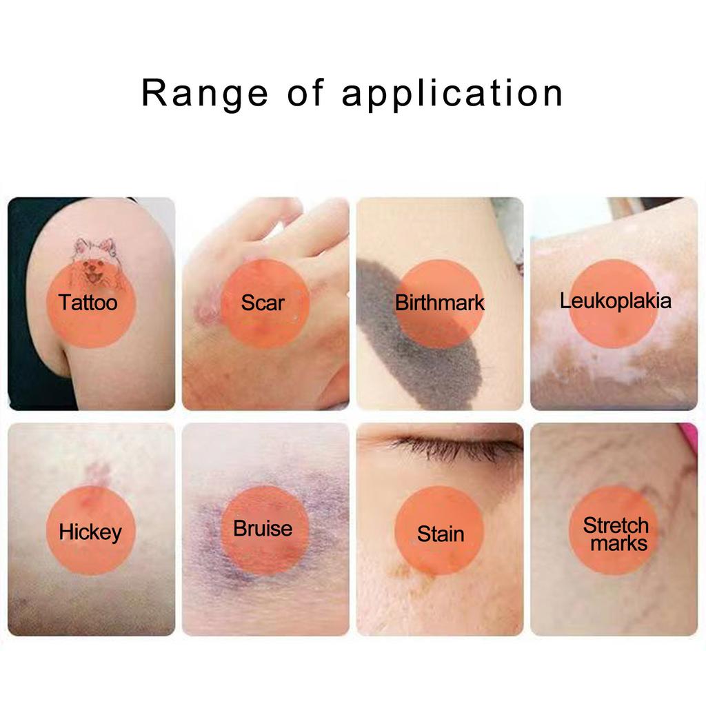 6 листов водонепроницаемой маскирующей ленты для кожи, наклейки для маскировки татуированных изъянов, наклейки для маскировки изъянов шрамов для свадеб