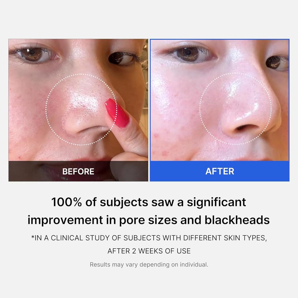 Medicube Zero Pore Pads 2.0, двухтекстурные тонизирующие подушечки для лица для отшелушивания и ухода за порами (3 варианта)