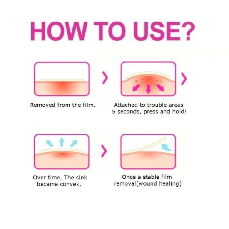 Acne Cover Spot Patch for Olive Young Care Plus Spot Patch (102ea) Acne Spot Pimple Absorbing Cover Patch, Moist Wound Dressing