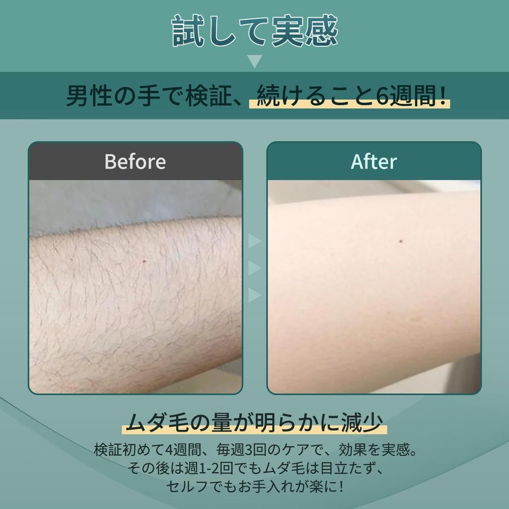 Безболезненная эпиляция салона IPL Light Hair Removal Machine Datsumouki Home Epilator Tusuny Epilator Совместимость с VIO Full Body Unwant Hair Care