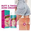 Buttock Care Cream  Acne Whitening Cream  Buttock Acne Care Cream  Smooth Skin Gentle And Non Irritating 100g
