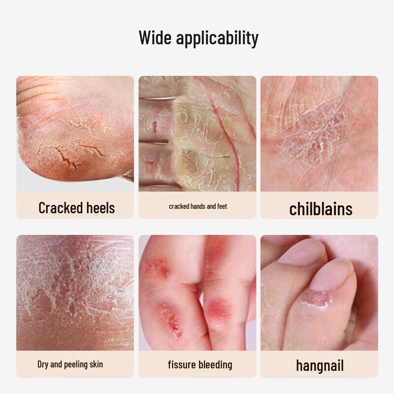 Yongan Hubiao Шафрановый крем для восстановления потрескавшейся кожи