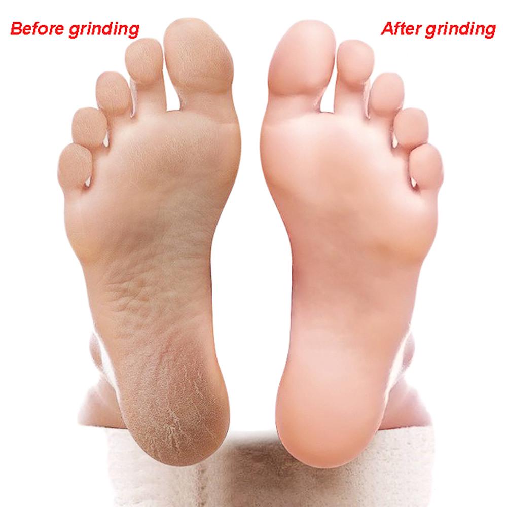 Double Sided Heel Grater Exfoliating Dead Skin Remove Foot Rasp Skin Care Pedicure Tool Foot File