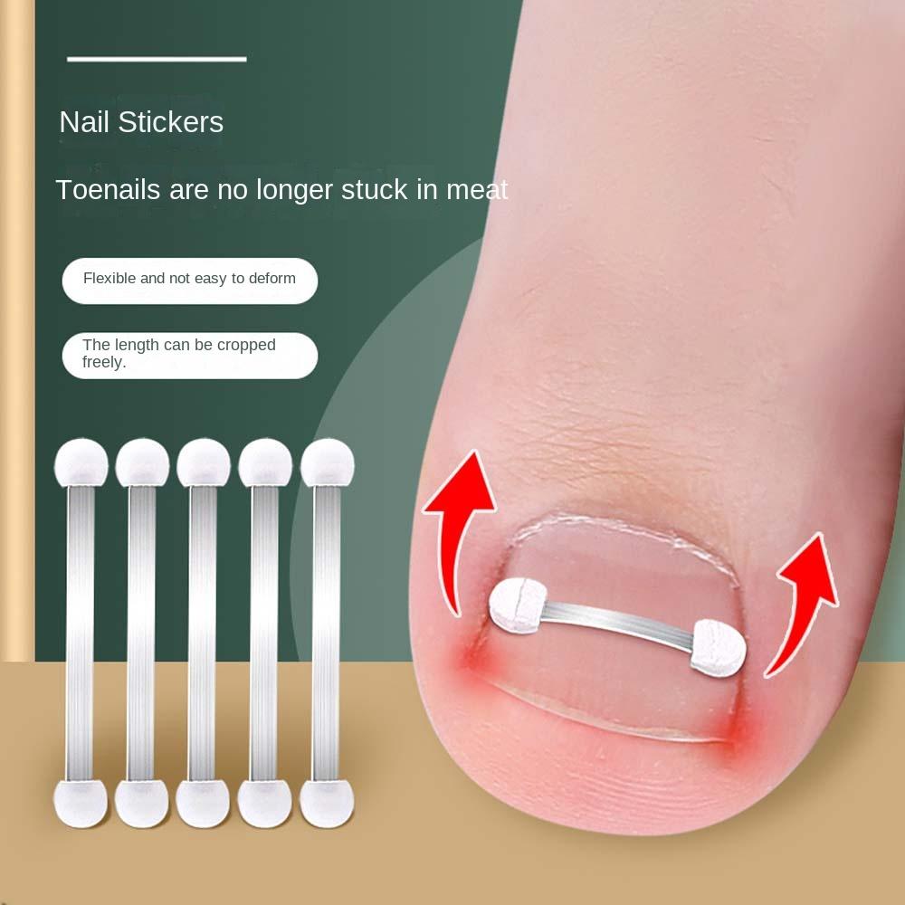 Pedicure Tool Ingrown Toenails Corrector Toenail Fixer Bunion Corrector Toenail Straightener