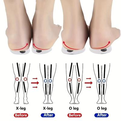 1 пара ортопедических стельок для ног O/X, коррекция вальгусной деформации для мужчин и женщин, силиконовая гелевая стелька для обуви, магнитные массажные подушечки для обуви